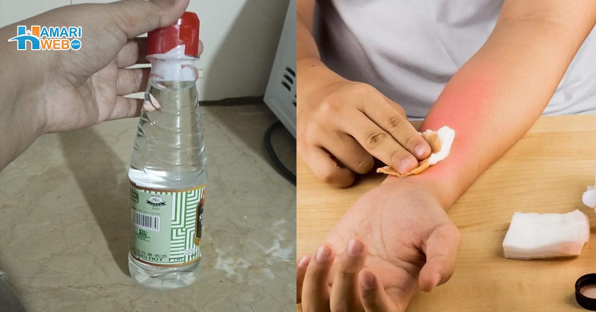 ہاتھ جل جائے تو سرکہ لگانے سے آرام ملتا ہے۔۔ جانیں عام سے سرکے کے 5 زبردست فائدے، جو آپ کے کام آئیں