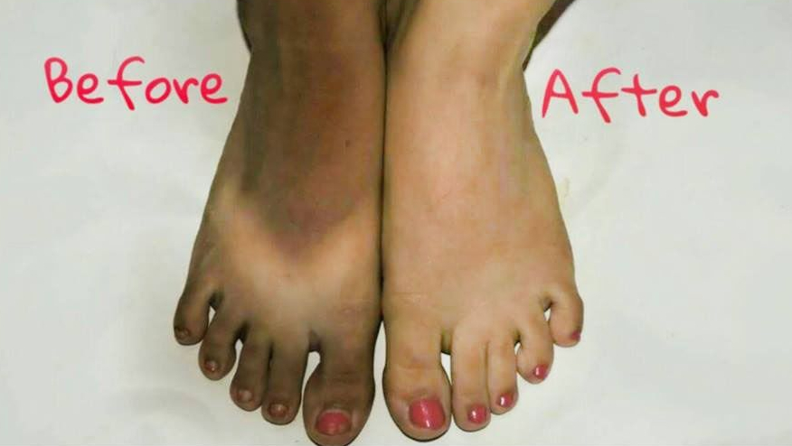 سورج کی تبتی شعاعوں کی وجہ سے چہرے ہاتھ اور پاؤں کی جِلد جھُلس گئی ہے؟ تو بنائیں انہیں پہلے جیسا چمکدار بتائے گئے آسان طریقے سے