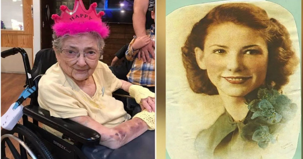 اعضاء غلط جگہ ہونے کے باوجود خاتون 99سال زندہ رہیں