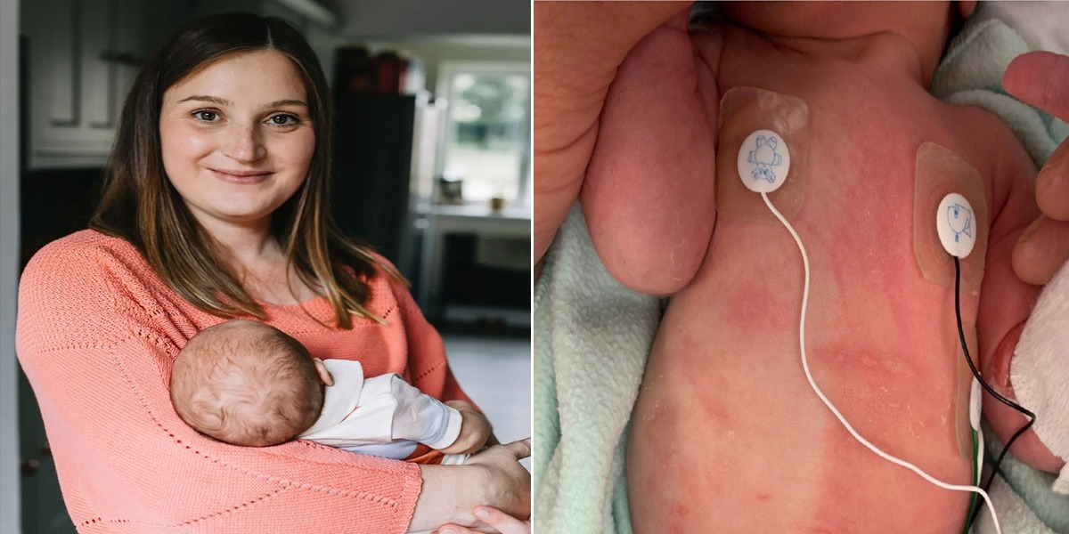 دوبارہ ماں بننے کیلئے کوششیں کر رہی تھی جب بچہ پیدا ہوا تو اسے گود بھی نہ لے سکی ۔۔۔ اپنے ہی بچے سے الرجی ہونے والی اس ماں کو کون سی انوکھی بیماری ہے؟