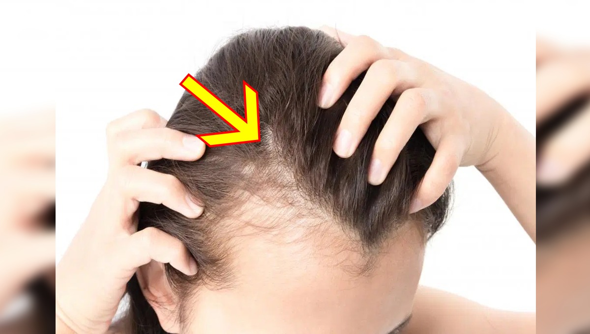 گنج پن سے بچنا چاہتے ہیں تو ان 5 غذاؤں کا استعمال لازمی کریں کیونکہ یہ ۔۔۔۔۔۔۔۔