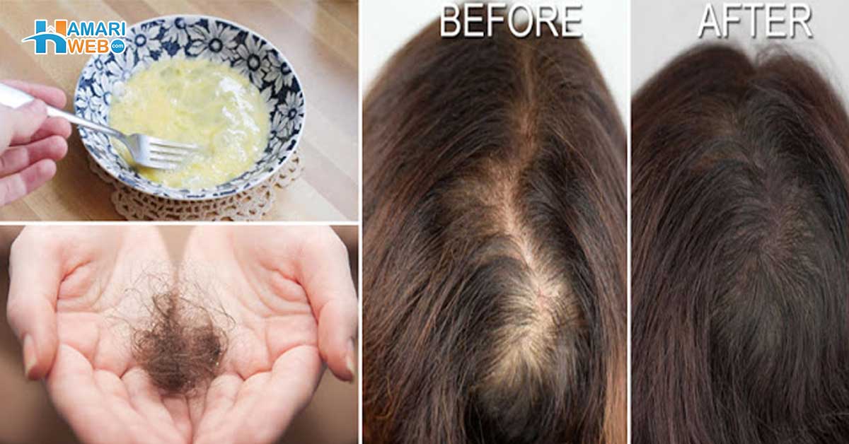 چھوٹی عمر میں ہی گنج پن آنا شروع ہوگیا۔۔ جانیں گنج پن کا علاج کیسے ممکن ہے اور اس سے چھٹکارا پانے کا قدرتی طریقہ کیا ہے؟