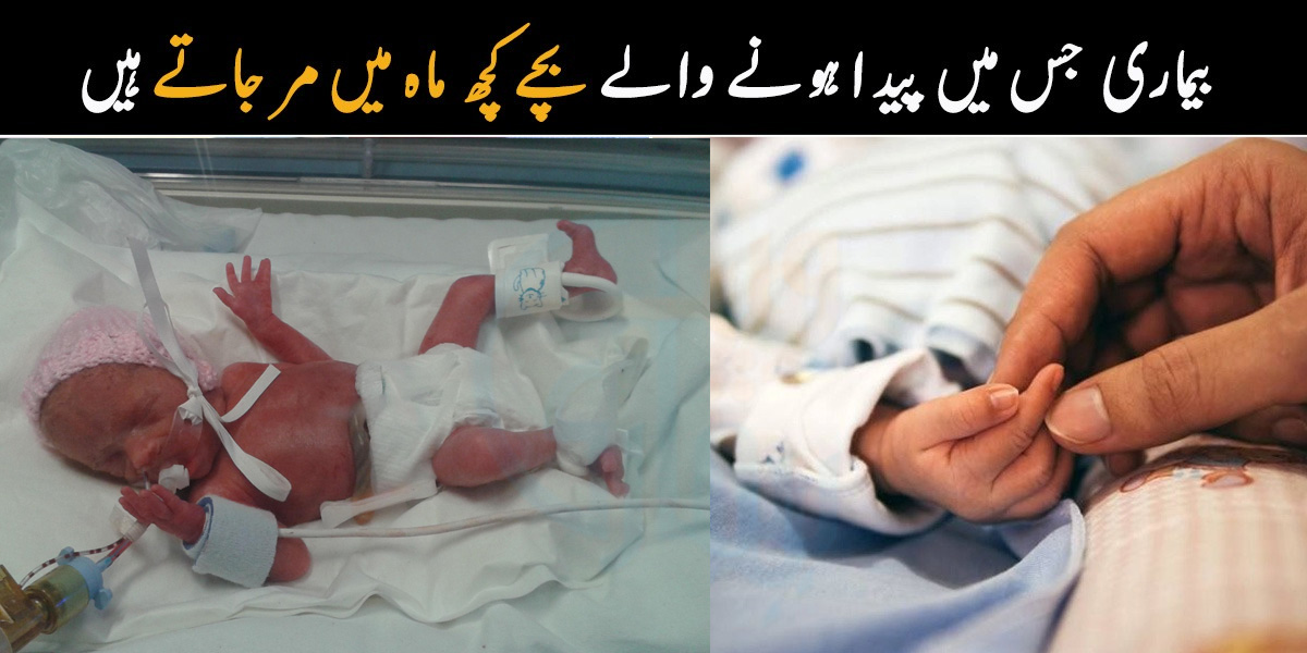پہلے بچے کا رنگ بدلتا ہے اور پھر وہ کچھ ہی دن جیتا ہے ۔۔ جانیے وہ کون سی بیماری ہے جس میں پیدا ہونے والے بچے کچھ ماہ میں مر جاتے ہیں؟