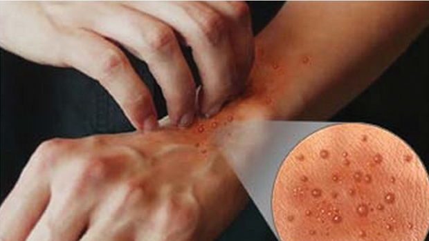 خواتین میں جلد کے مسائل اور ان کا حل٬ ڈاکٹر بلقیس شیخ